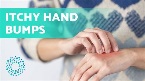 Itchy Bumps On The Back Of Hands Causes Itchy Hands With Pimples