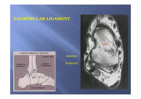 Mri anatomy of ankle | PPT