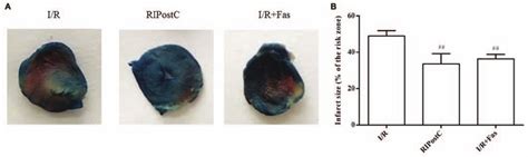 Alterations To Myocardial Infarct Size In Rats A Representative