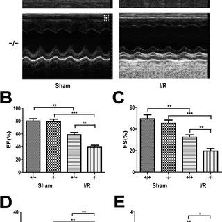 Plin5 Deficiency Aggravates Heart Dysfunction Following I R Injury A