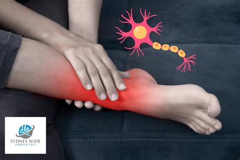 Nerve Related Foot Pains | Sydney Wide Podiatry