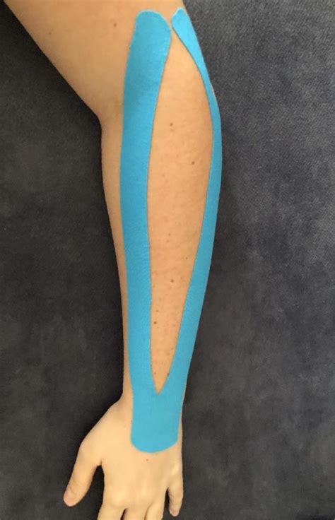 Evaluation Of Short Term And Residual Effects Of Kinesio Taping In