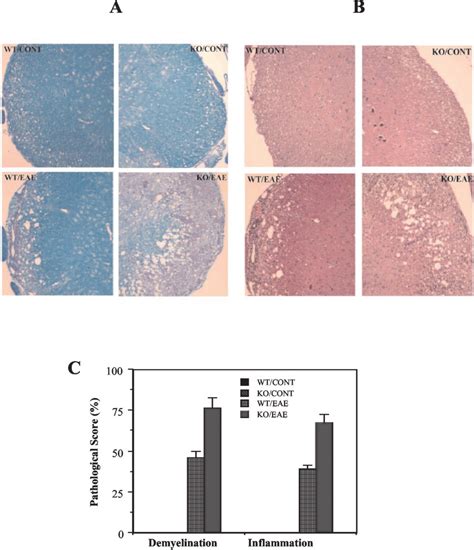 Pathology Of Spinal Cord Sections From Wild Type And Ppar Mice