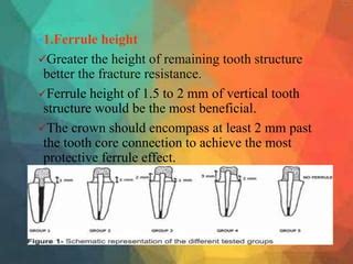 Ferrule 3 | PPT