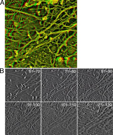 A Series Of Sliced Images Of The Actin Msk On The Plasma Membrane