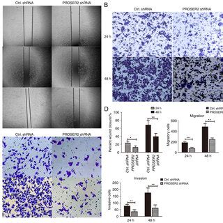 PROSER2 Knockdown Inhibits Proliferation And Migration Of MG63 Cells