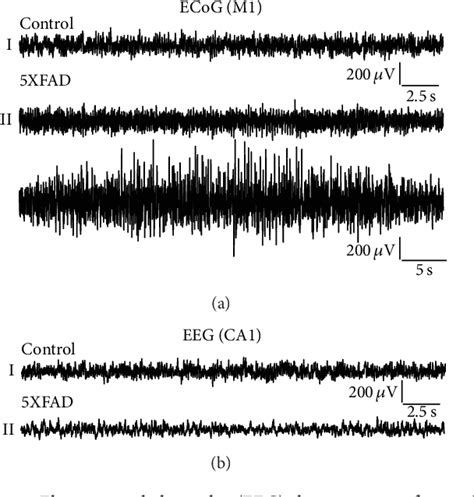 Figure 1 From Altered Theta Oscillations And Aberrant Cortical