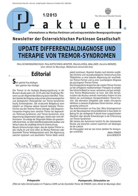 Update Differenzialdiagnose Und Therapie Von Tremor Syndromen