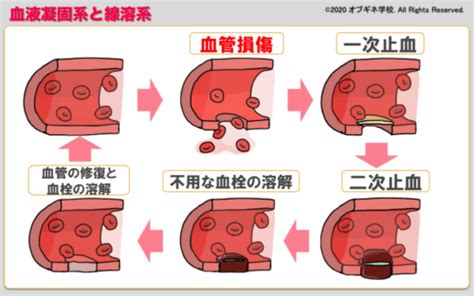 産科DICと血液凝固 新しい切り口の産婦人科学講座見えてくる産婦人科学 オブギネ学校