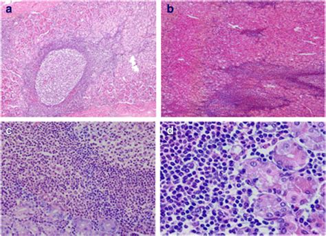 A Lymphoid Follicles Located In The Gastric Mucosa Hex10 B Download Scientific Diagram