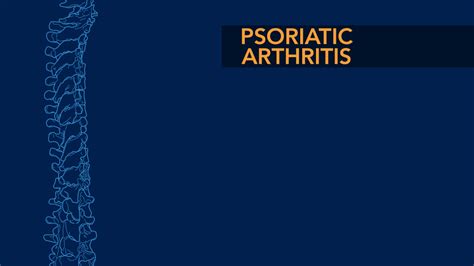 Psoriatic Arthritis - Spondylitis of The Spine - The Spine Community