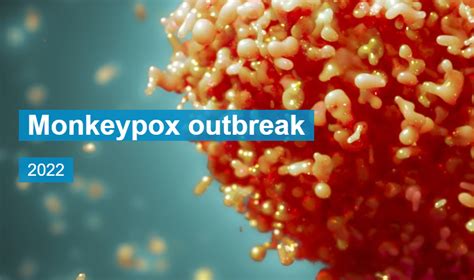 Monkeypox Outbreak 2022 – UW Health Sciences Library