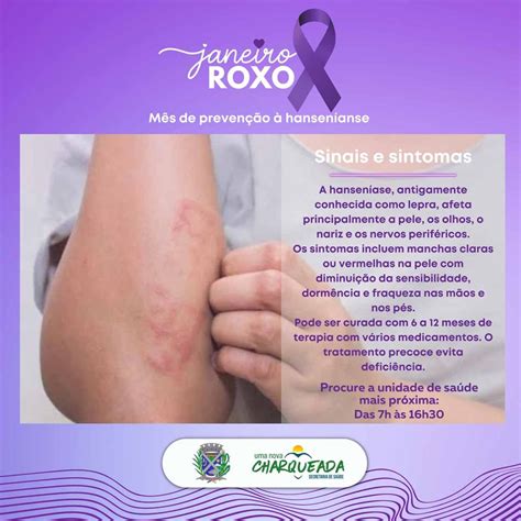 Charqueada Realiza Neste M S A Campanha Janeiro Roxo Para