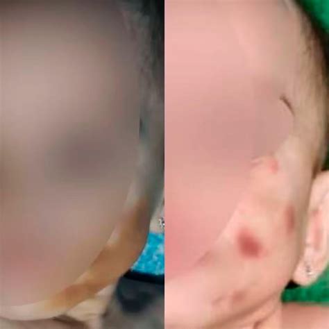 Suspeita de maquiar rosto de bebê para esconder hematomas mãe é