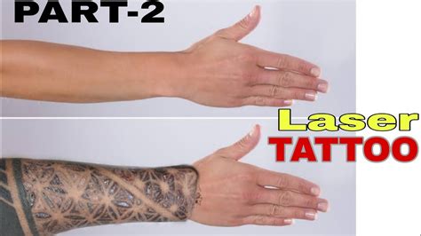 How To Remove Tattoo At Home How To Remove Tattoo Permanently