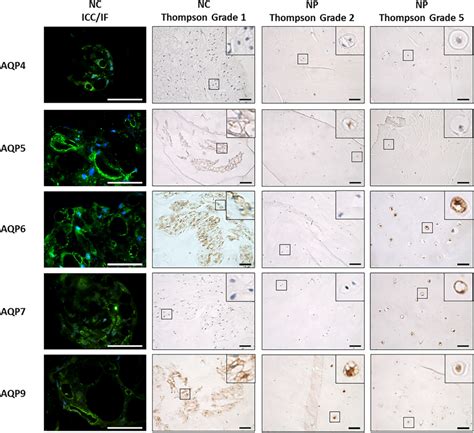 Expression And Localization Of Aquaporins Aqps In Native Canine