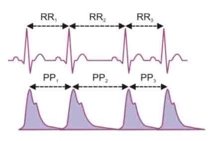 Pulse Wave Analysis