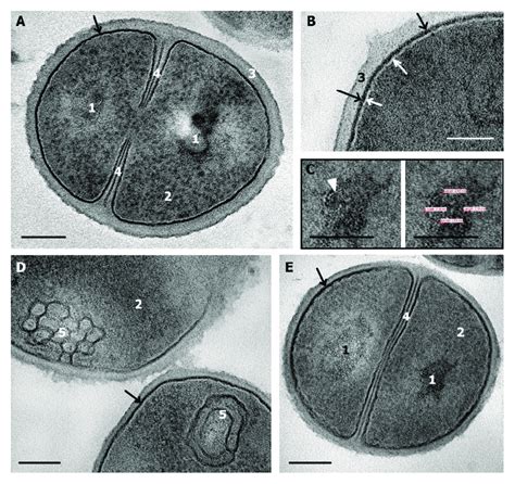 S Aureus Control Normal Cells A Dividing Cell B Structure Of