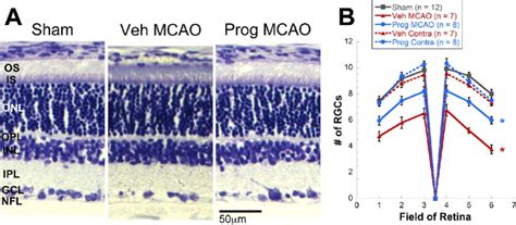 Representative Photographs Of Cresyl Violet Staining And Quantification