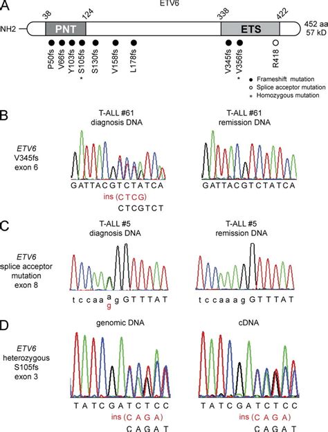 Etv Mutations In Early Immature Adult T All A Schematic