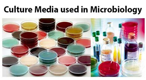 List Of Culture Media Used In Microbiology With Their Uses Microbiology