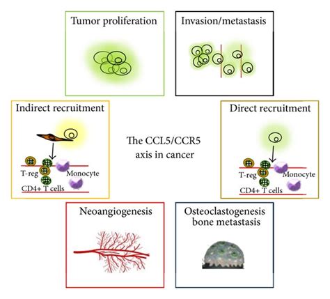 The Inflammatory Chemokine Ccl5 And Cancer Progression Aldinucci