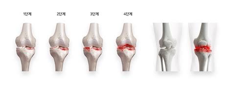 진료내용 서울척병원