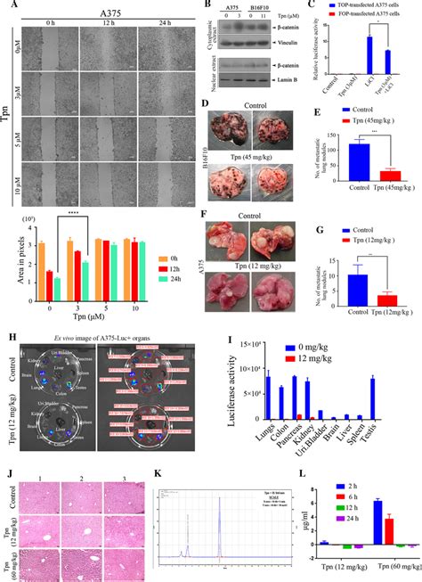 Suppression Of Melanoma Migration And Metastasis By Tpn A Scratch Wound