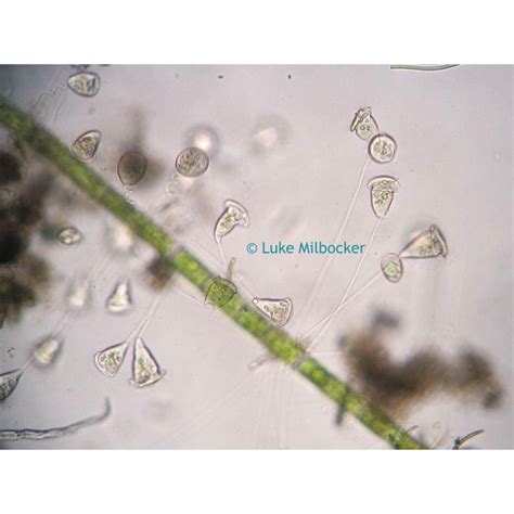 Microscopy Protozoans | Microbus Microscope Educational Website