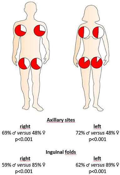 Frontiers Sex Disaggregated Population Analysis In Patients With