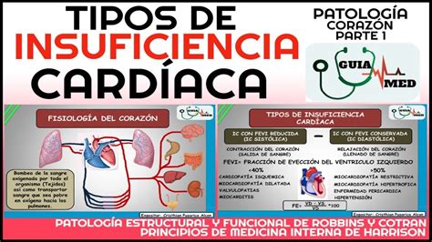 Insuficiencia Card Aca Derecha E Izquierda Fisiopatolog A Guiamed