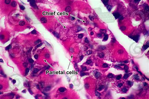 Man Stomach Transverse Section 1000x Stomach Man Mammals