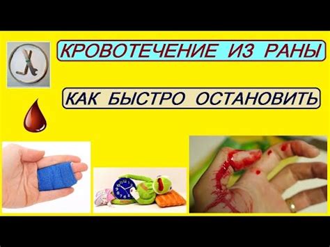Как быстро остановить КРОВЬ при ПОРЕЗАХ - YouTube