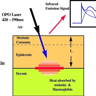 Opto Thermal Skin Pigment Depth Profiling A Typical Infrared Emission