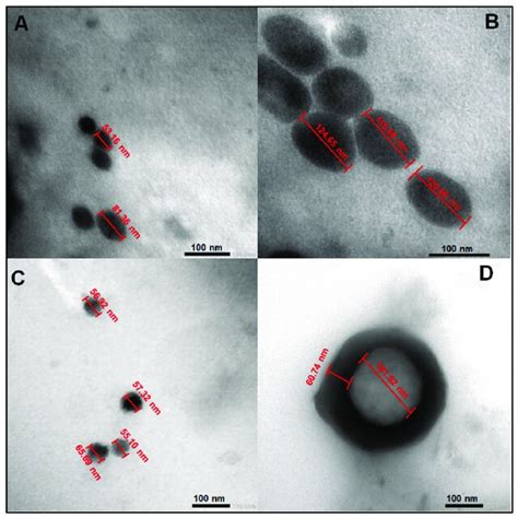 Transmission Electron Microscopy TEM Images Of PEGylated PLGA MA NPs