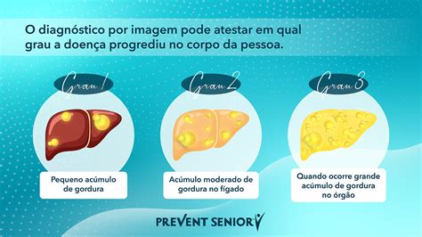 O Que é Calcificação No Figado LIBRAIN