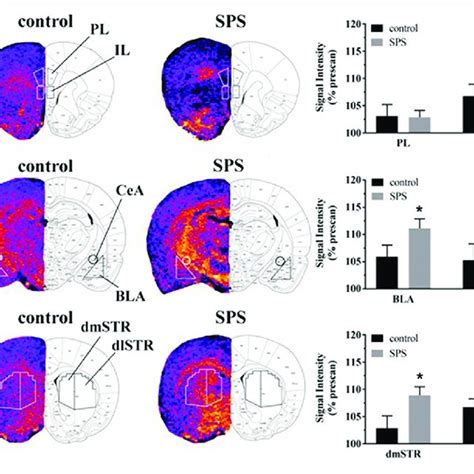 Summary Of Metabolites In The Medial Prefrontal Cortex MPFC As