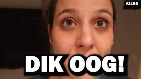 DIK PIJNLIJK OOG JOLIEN EN JENNO VLOG 2195 YouTube