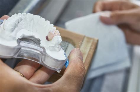 Dental Technician Working with Tools To Do Ceramic Dental Implants in His Laboratory Stock Image ...