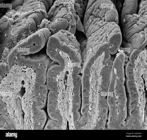 Intestinal Lining Scanning Electron Micrograph SEM Of A Freeze