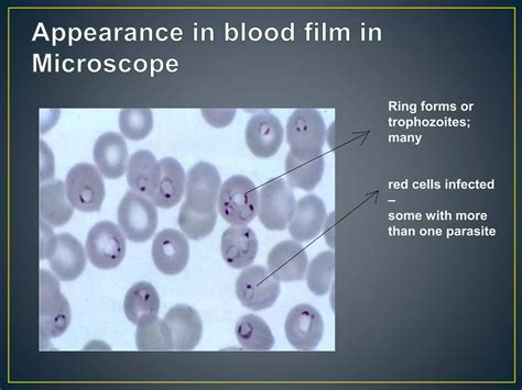 Malaria parasite | PPT