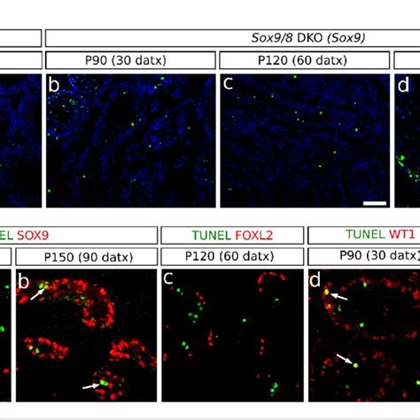 Incidence Of Apoptosis In Sox98 Sc Dko Testes A Tunel Staining In