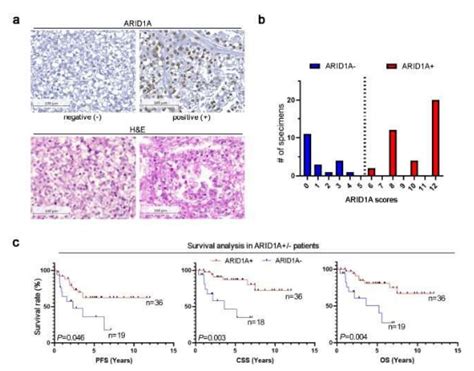 Cancer Res Commun：一种特殊蛋白或与卵巢癌患者较好的治疗预后直接相关生物科技健康一线资讯