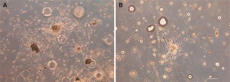 Proliferation And Adipogenic Differentiation Of Human Adipose Derived