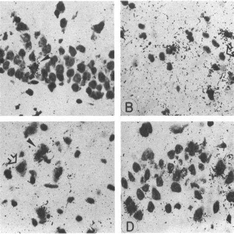 Photomicrographs Showing C Fos Mrna Expression In Selected Brain