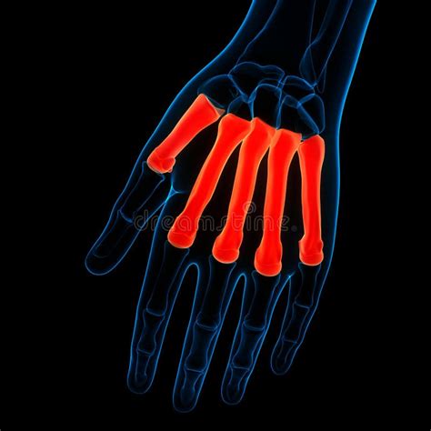 Human Skeleton System Metacarpal Bone Joints Anatomy Stock Illustration - Illustration of elbow ...