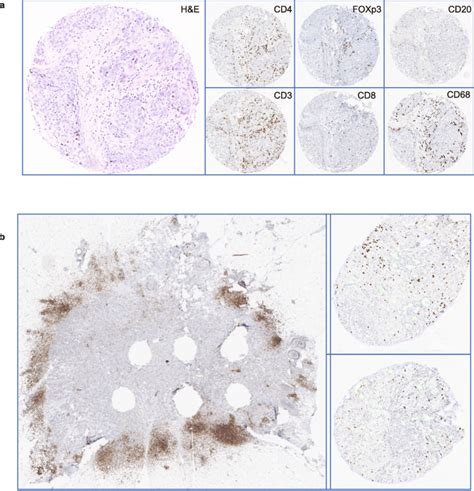 Immunohistochemical Assessment Of Immune Cells A Immunohistochemical