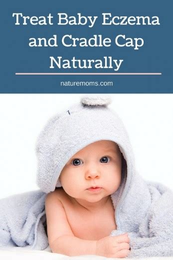 Treat Baby Eczema And Cradle Cap Naturally