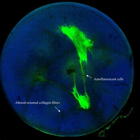 The Multiphoton Autofluorescence And Shg Imaging Of The Whole