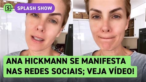 Ana Hickmann Se Manifesta Pela Primeira Vez Nas Redes Sociais Assista